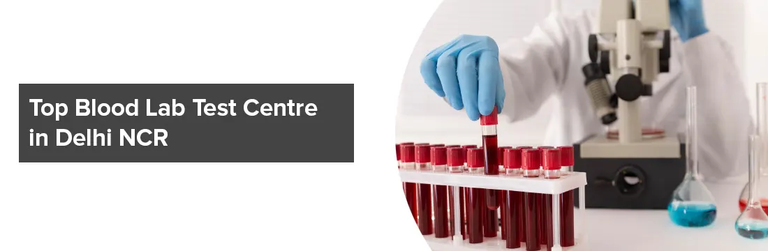  Top Blood Lab Test Centre in Delhi NCR